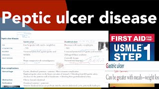 Peptic ulcer disease Gastric ulcer vs Duodenal ulcer in HindiUrdu by first aid for USMLE step 1 [upl. by Gati457]