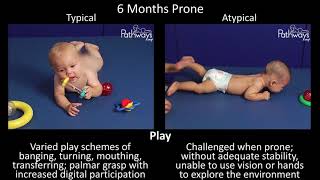 6 Month Old Baby Typical amp Atypical Development Side by Side [upl. by Hoj694]