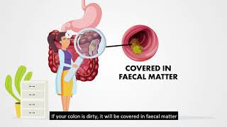 Colonoscopy Preparation  By NUH Colorectal Centre [upl. by Glynis483]