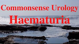 Commonsense Urology Haematuria [upl. by Heydon]