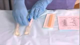 Sample Collection Throat swabs [upl. by Teece]