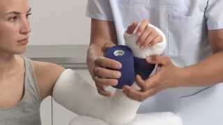 Plaster of Paris Elbow Splint Application [upl. by Nylla]