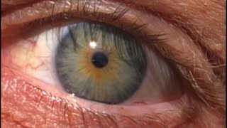 Central Heterochromia Spiritual Meaning [upl. by Gorga857]