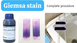 Giemsa Stain Procedure for Blood SmearHow to do Giemsa StainGiemsa Staining ProcedureAdnanMLT [upl. by Anaili452]