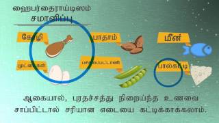 Hyperthyroidism Managing Hyperthyroidism Tamil [upl. by Eruza]