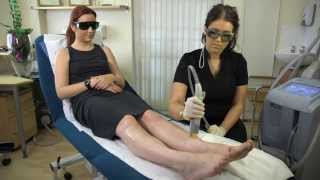 Cutera CoolGlide Laser Hair Removal  Patient Treatment Review  Refresh Laser Clinic Sheffield [upl. by Tillinger]