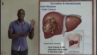 34 Liver Diseases Part 2 Biology Form 2 [upl. by Nnyllatsyrc882]