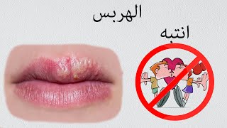 herpes simplex virus ما هو فيروس الهربس و كيف نصاب به [upl. by Imik]