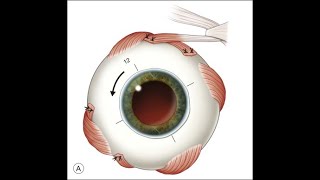 ANATOMY OF EXTRAOCULAR MUSCLES COMMON TENDINOUS RINGNERVE SUPPLYACTIONCLINICAL IMPORTANCE [upl. by Atikaj]