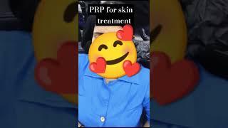 PRP for skin treatment asthetic [upl. by Devan247]