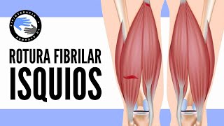 Rotura fibrilar de los isquiotibiales que es por que se produce diagnostico y tratamiento [upl. by Arakawa606]