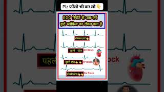 ECG Report stage ecg education gk [upl. by Valeria279]