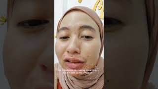 H3 CLEANSING OILYKRIM PENETRAL ZULFA SKIN CLINIC PACITAN [upl. by Atterbury756]