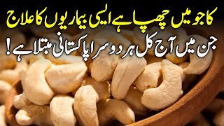 Benefits Of Cashew  Kaju K Fayde Urdu Hindi [upl. by Cicely]