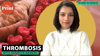 What is thrombosis [upl. by Nnaaihtnyc88]