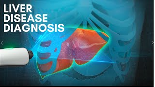 Liver Disease Diagnosis 3D medical animation 2022 [upl. by Chandler]