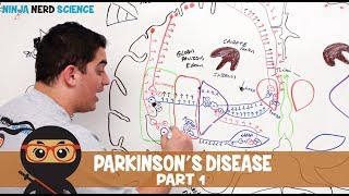 Parkinsons Disease  Clinical Presentation  Part 1 [upl. by Inacana]