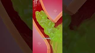 How acid reflux happens 🥵 Acidity and gas problem  GERD shorts viralvideo  creativelearning3d [upl. by Darrej]