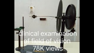 Field of Vision  Cranial Nerve II Examination  Perimetry [upl. by Im]