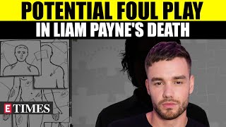 New Autopsy Findings Reveal Crucial Evidence in Liam Paynes Mysterious Death Fan Suspect Foul Play [upl. by Kcirej]