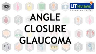 Primary and Secondary Angle Closure Glaucoma [upl. by Latreece235]