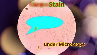 Klebsiella under Microscope Klebsiella Gram Stain [upl. by Uyr]