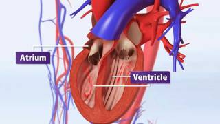 Atrial Fibrillation Animation Explained AFib amp Risk of Stroke [upl. by Alsworth]