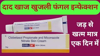 दाद की दवा  Exel M Skin Cream Uses  दाद खाज खुजलीफंगल इनफेक्शनस्किन इन्फेक्शन [upl. by Normie]