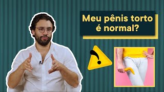 Penis torto é normal O que é a DOENÇA DE PEYRONIE [upl. by Rollin120]