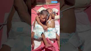 Two Premature Baby Journey medical newbornbaby viralvideo [upl. by Langston]