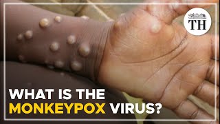 What is the monkeypox virus  The Hindu [upl. by Ataymik176]