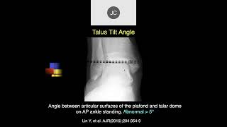 MRI of the Ankle Part 7 – Ankle Tendons [upl. by Nirtiak410]