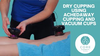 Clinical Dry Cupping with Achedaway and Vacuum Cups [upl. by Codi]