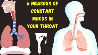 The 6 Causes of Constant Mucus phlegmy in Your Throat  constant coughing and throat clearing [upl. by Lledroc154]