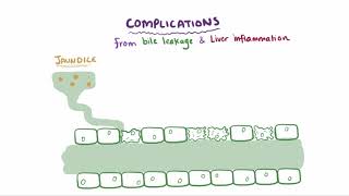 Primary biliary cholangitis causes symptoms diagnosis treatment amp pathology [upl. by Christine]