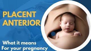 Placenta Anterior What It Means for Your Pregnancy [upl. by Aicinoid]