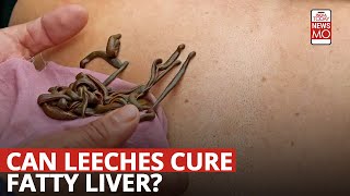 On ‘Navroz’ Hundreds Let Leeches Suck Their Blood To Get Rid Of Longtime Aliments [upl. by Erotavlas]