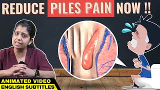 Animation Piles Pain Relief Hemorrhoids  மூல நோய் குணப்படுத்த எளிய வழிகள் [upl. by Aiyram]