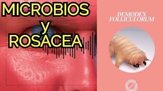 La MICROBIOTA y enfermedades de la piel como la ROSACEA [upl. by Masao]