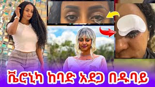 Veronica Adane  ቬሮኒካ አዳነ በዱባይ ከባድ አደጋ እንደደረሰባት ተናገረች  Veronica Adane In Dubai [upl. by Beltran]