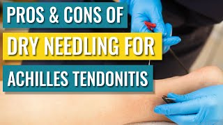 Dry Needling For Achilles Tendinopathy  Tendonitis — Does It Help [upl. by Feola]