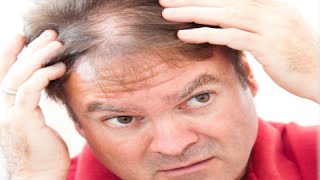 How to Regrow Hair in Thinning Areas  Hair Regrowth Tips [upl. by Ohcamac]