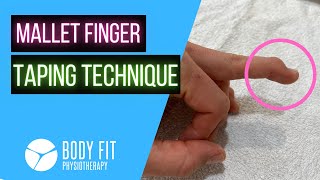 Mallet Finger I Taping Technique [upl. by Airottiv]