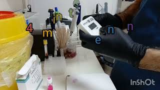 2ME Test2Mercaptoethanol پشکنینی [upl. by Norrat]