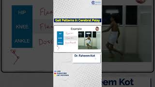 Dr Faheem Kotekar Explains Gait Patterns in Cerebral Palsy  Conceptual Orthopedics [upl. by Yrod]