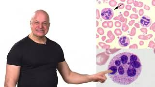 Hematology 2 Macrocytic Anemia  Conrad Fischer [upl. by Aronoh]