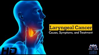 Laryngeal Cancer Silent Struggles and Hopeful Treatments [upl. by Hamrah324]