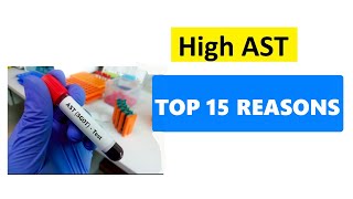 HIGH AST LEVELS  TOP 15 REASONS [upl. by Sosanna343]