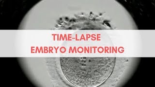 Timelapse Embryo Monitoring [upl. by Alexa265]