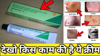 देखो BetnovateN क्रीम की हैरान करने वाली पूरी सच्चाई  BetnovateN cream review  SG support [upl. by Yrdnal]